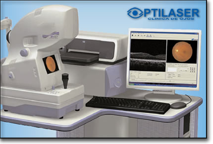 Clinica de ojos Optilaser - Tomografia optica